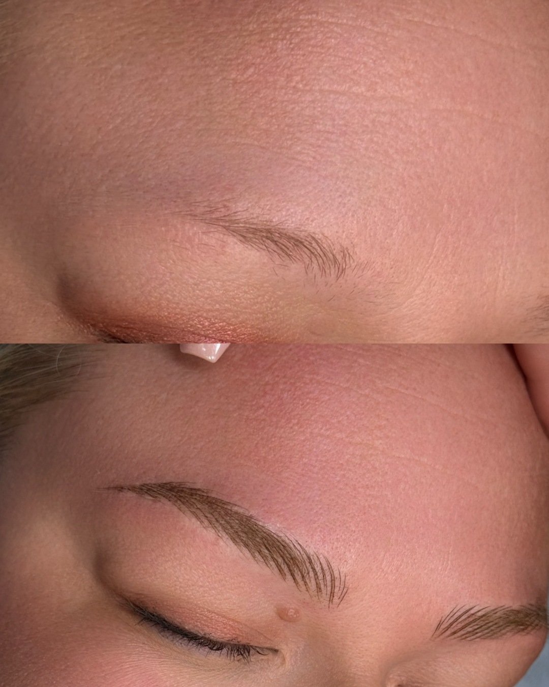 PMU before & after collage